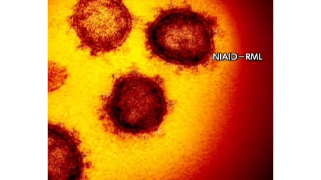 北海道ニュース Uhb Uhb 北海道文化放送 北海道ニュース Uhb Uhb 北海道文化放送