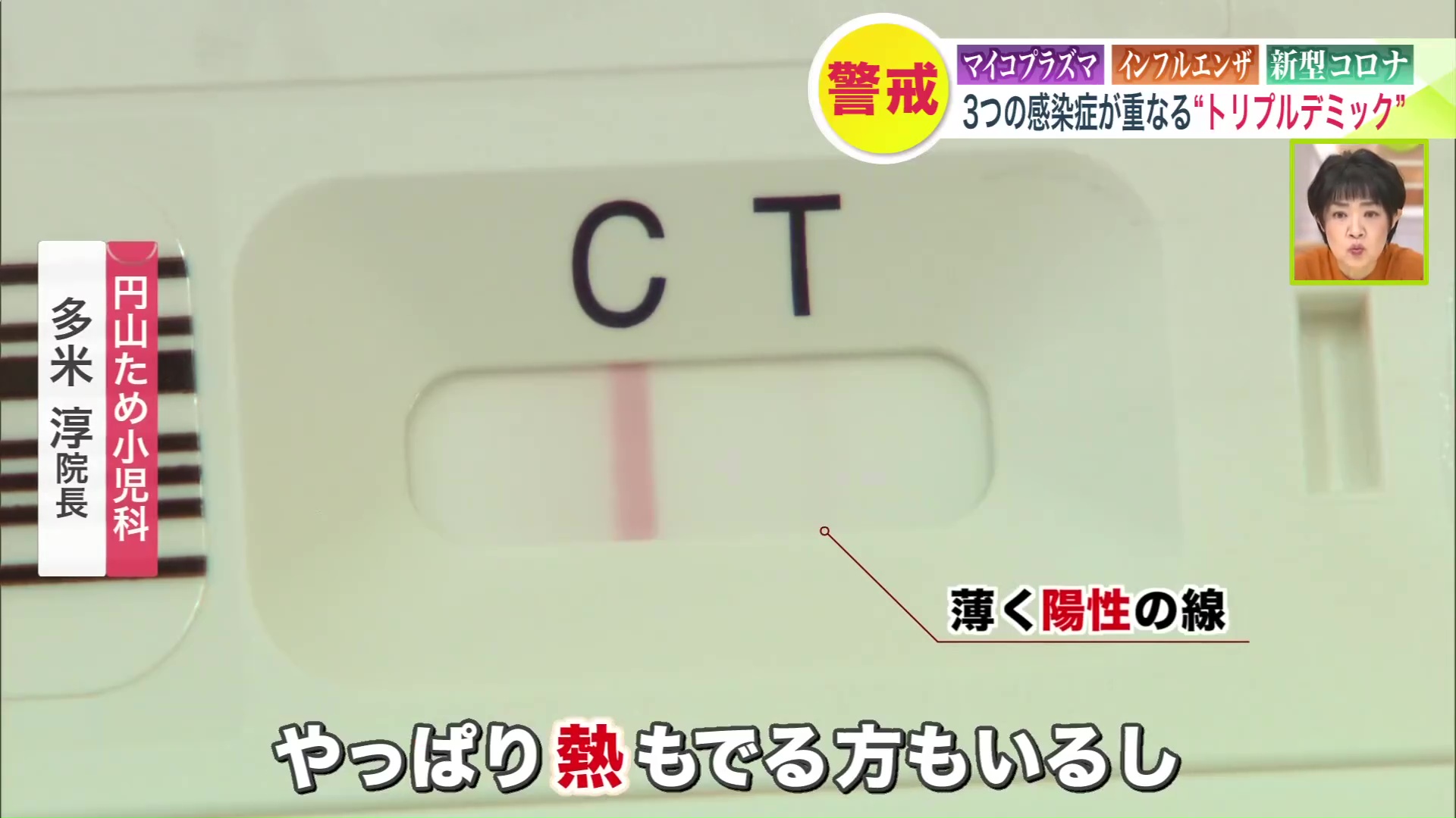 薄く出現する陽性の線