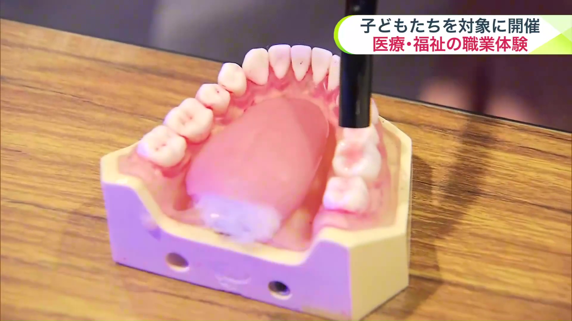 歯の治療を体験