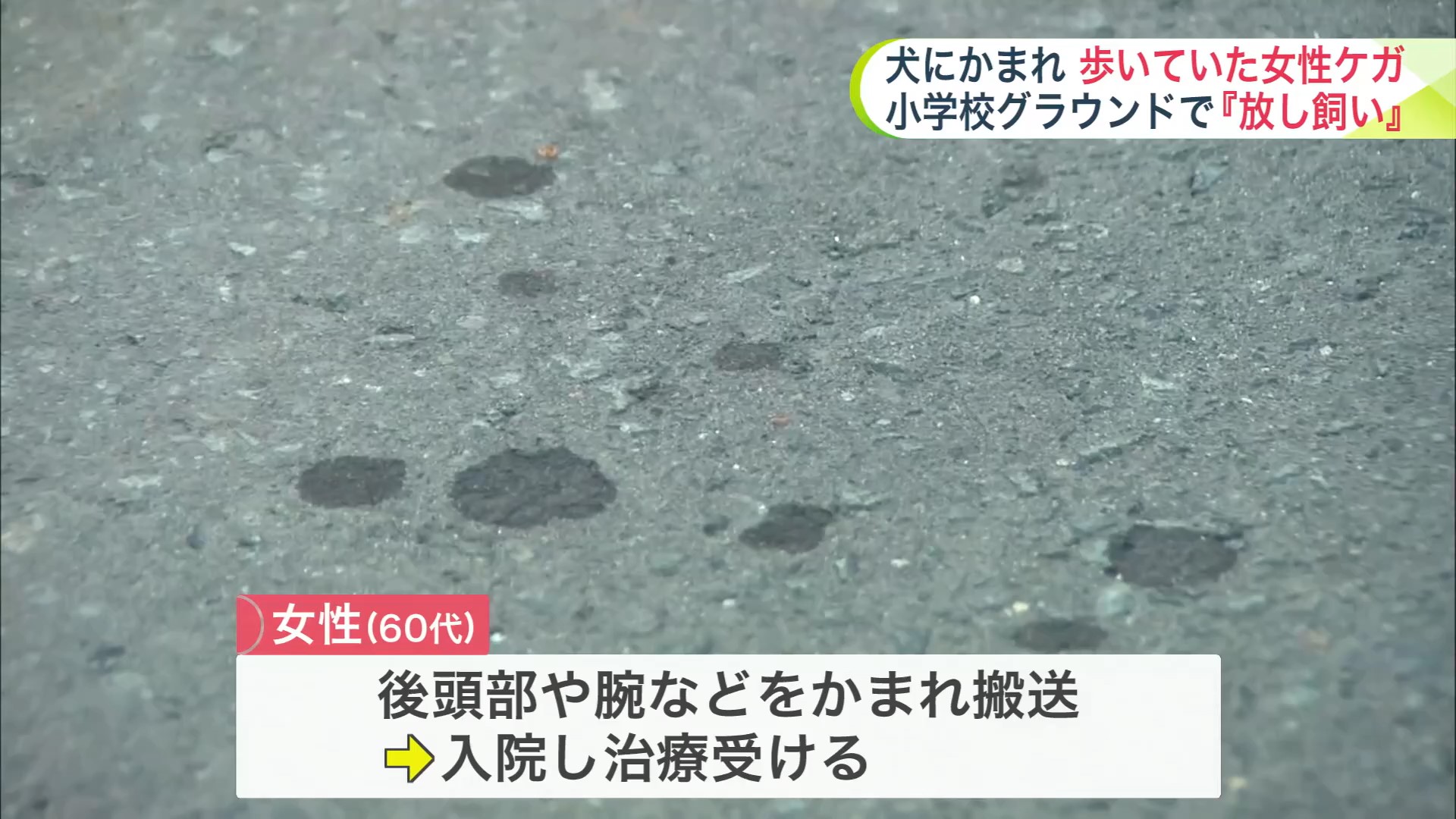 女性は後頭部や腕などかまれ搬送