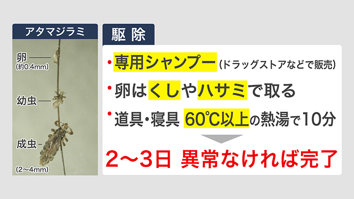 アタマジラミの駆除方法