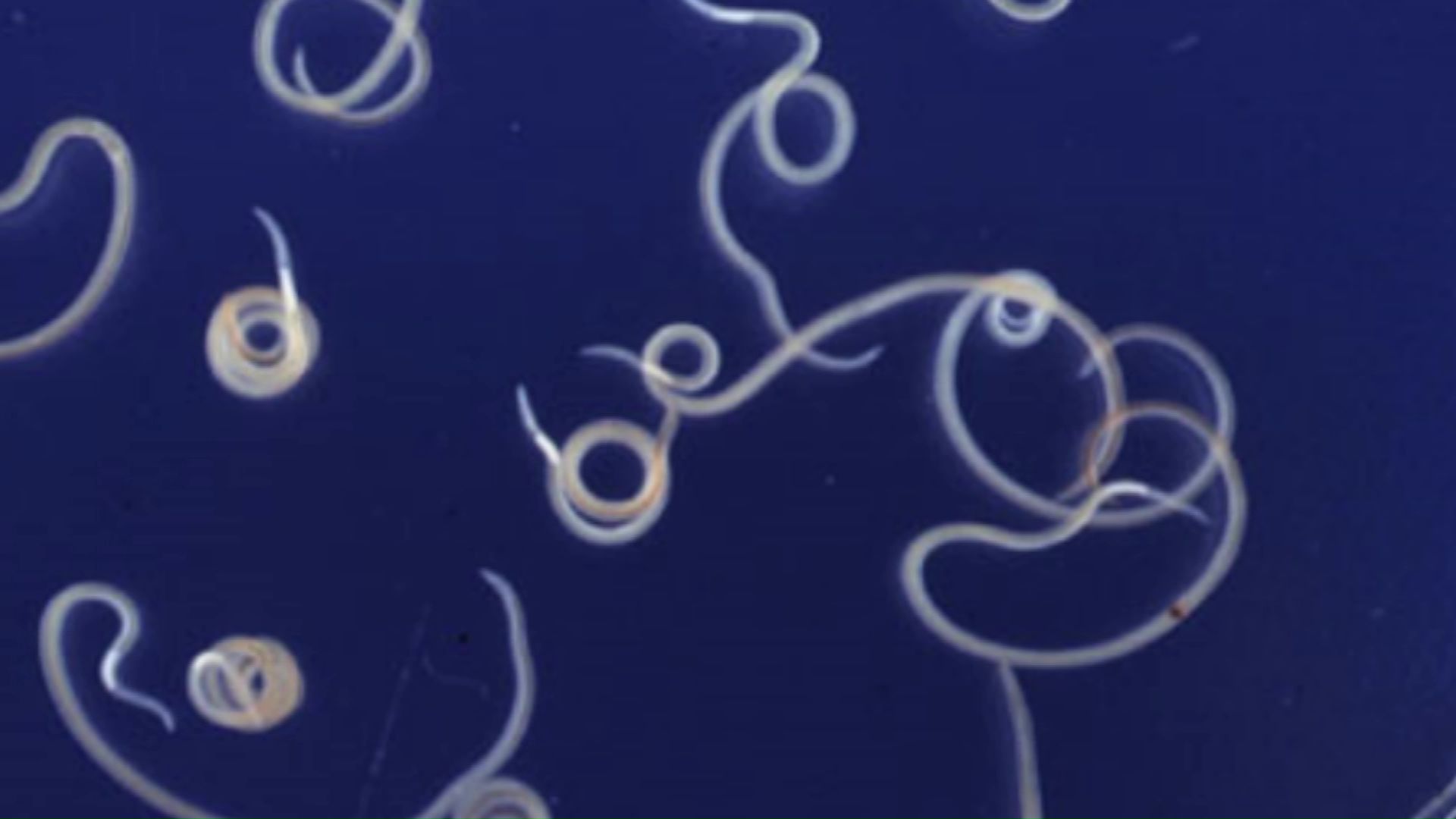 アニサキス(出典:国立健康危機管理研究機構 感染症情報提供サイト)