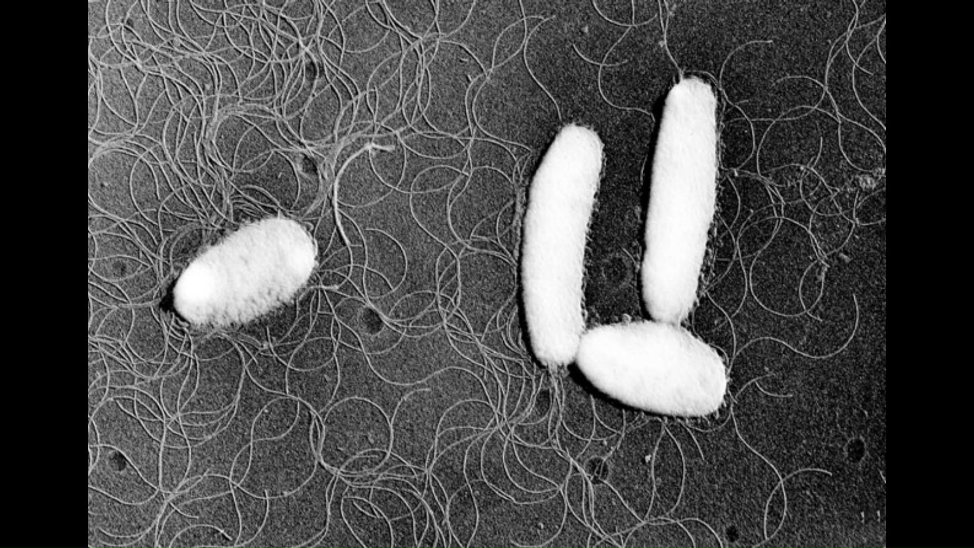 腸炎ビブリオ(提供:国立健康危機管理研究機構)