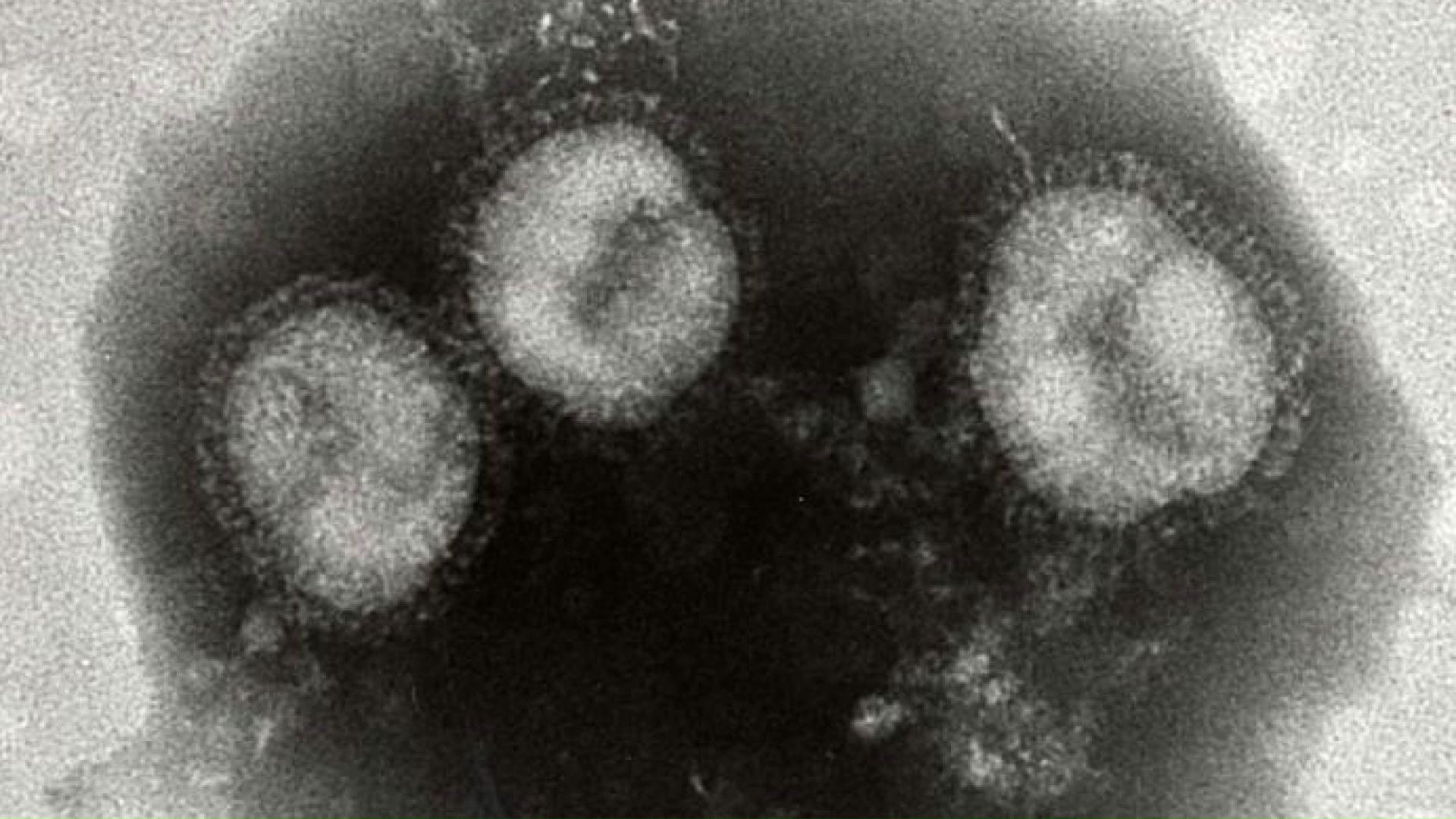 インフルエンザウイルス（提供：札幌市衛生研究所）