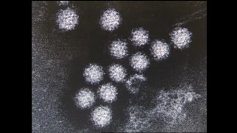 ノロウイルス（資料）