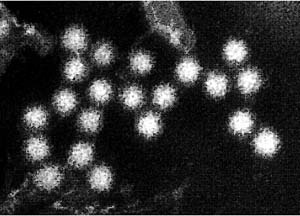 ノロウイルス(提供:北海道立衛生研究所)
