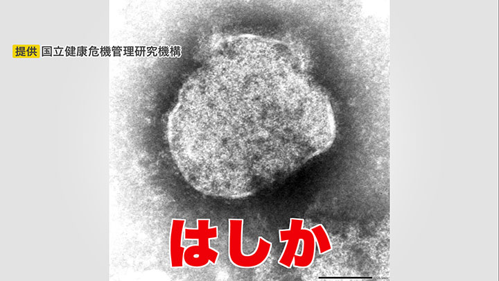 日本国内で感染者が増加している「はしか」(提供:国立健康危機管理研究期機構)