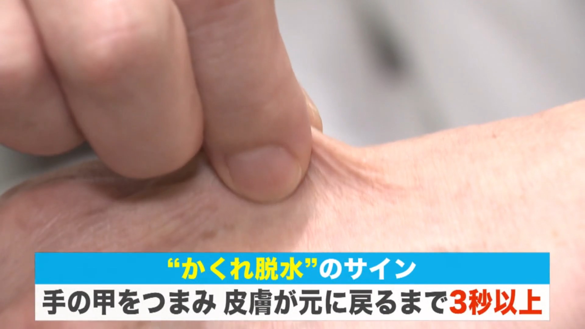 手の甲をつまみ、皮膚が元に戻るまで3秒以上は「かくれ脱水」のサインかも