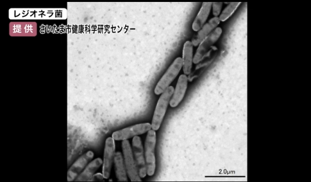 レジオネラ菌(提供:さいたま市健康科学研究センター)