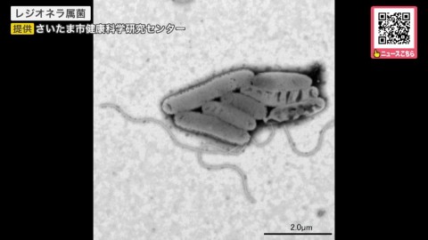 レジオネラ属菌（提供：さいたま市健康科学研究センター）