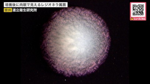 培養後に肉眼で見えるレジオネラ属菌（提供：道立衛生研究所）