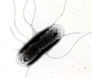 サルモネラ(salmonella) 提供:札幌市衛生研究所