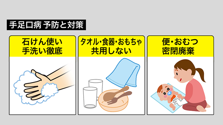 手足口病で気を付けたい3つのポイント