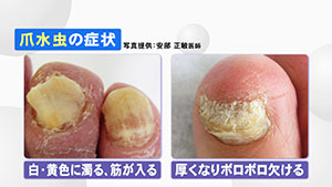 病を知る  みんテレ  番組情報  UHB 北海道文化放送