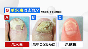 病を知る  みんテレ  番組情報  UHB 北海道文化放送
